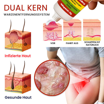 Cvreoz® FemGenital Warzenentferner Creme - LIMITED-TIME OFFER | Lassen Sie das beste Selbstvertrauen in sich heraus!💕