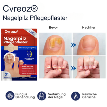 26 Packungen übrig! Cvreoz® Nagelpilz Pflegepflaster