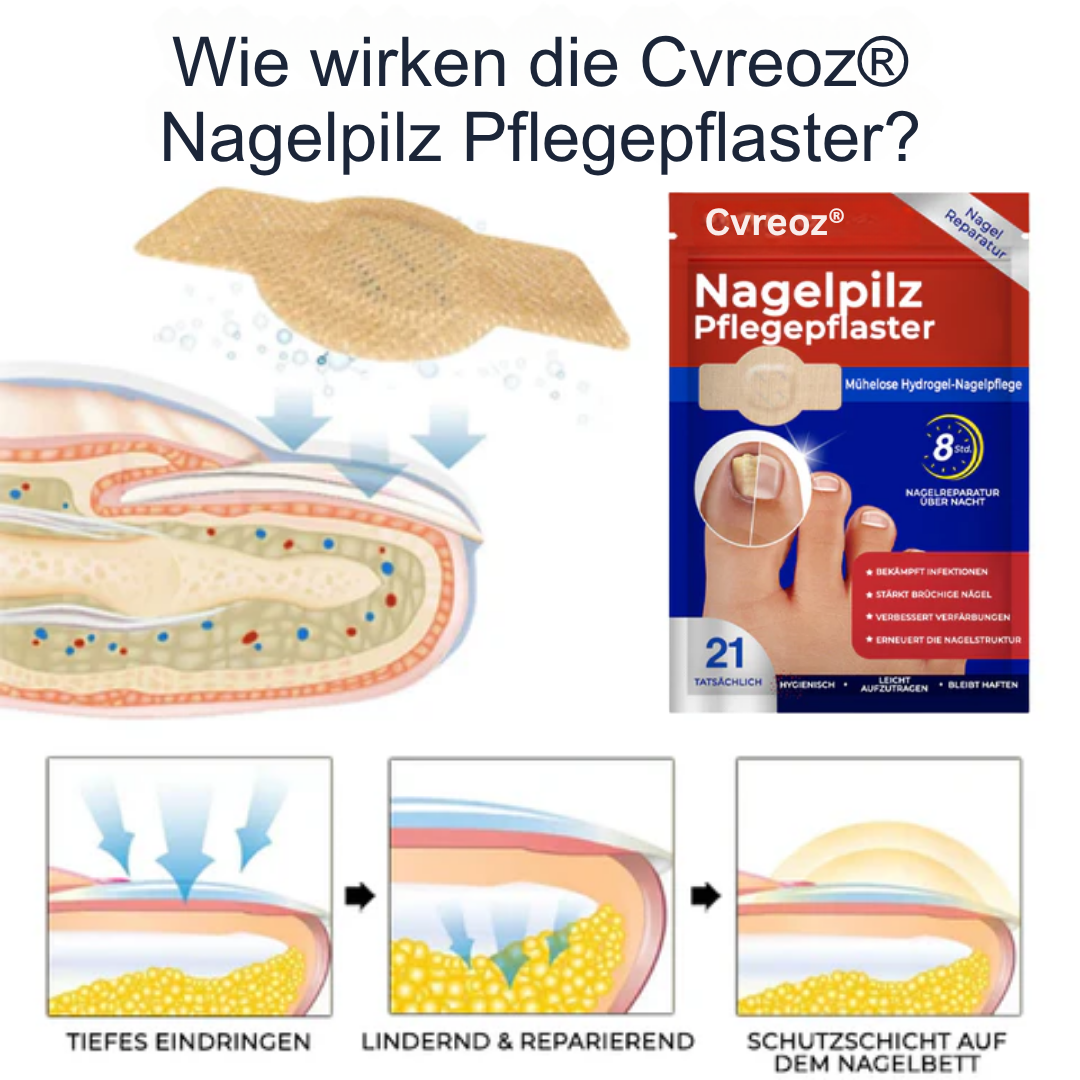 26 Packungen übrig! Cvreoz® Nagelpilz Pflegepflaster