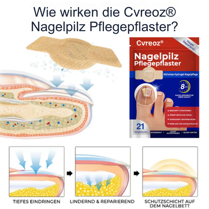 26 Packungen übrig! Cvreoz® Nagelpilz Pflegepflaster