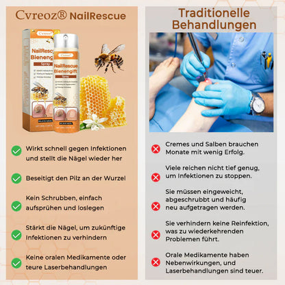56 Flaschen übrig!! Cvreoz® NailRescue Bienengift-Spray | Lassen Sie das beste Selbstvertrauen in sich heraus!💕