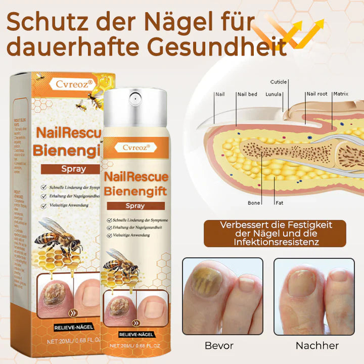 56 Flaschen übrig!! Cvreoz® NailRescue Bienengift-Spray | Lassen Sie das beste Selbstvertrauen in sich heraus!💕