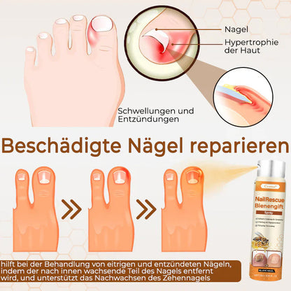 56 Flaschen übrig!! Cvreoz® NailRescue Bienengift-Spray | Lassen Sie das beste Selbstvertrauen in sich heraus!💕