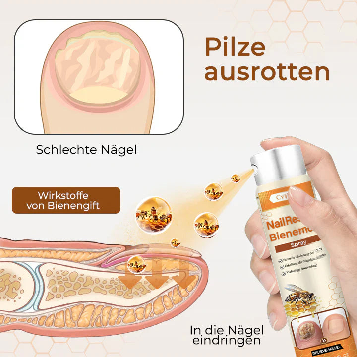 56 Flaschen übrig!! Cvreoz® NailRescue Bienengift-Spray | Lassen Sie das beste Selbstvertrauen in sich heraus!💕