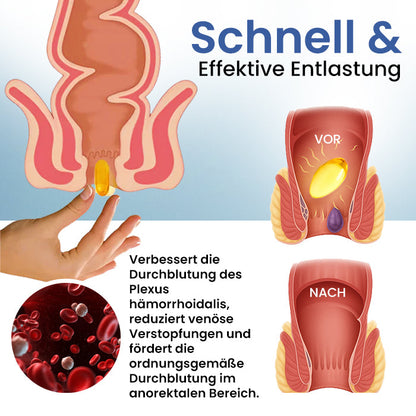 Cvreoz® Natürliche Hämorrhoiden-Kapseln |  | Lass dich nicht von Schmerzen aufhalten – JETZT KAUFEN!💕
