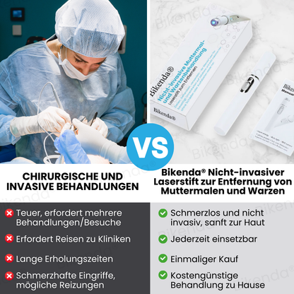 Bikenda® Nicht-invasiver Stift - und Warzenbehandlung Laserstift zum Entfernen