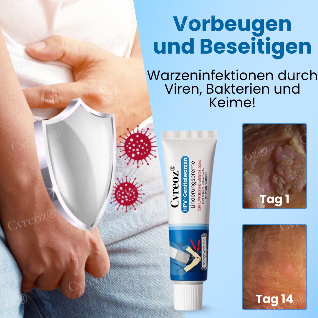 Cvreoz® HPV-Genitalwarzen Linderungscreme  | Nie wieder Juckreiz💕