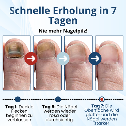 🏷️ EXKLUSIVES ANGEBOT! 50 % RABATT – AEXZR® MycoShield Pro Pilznagelpflaster