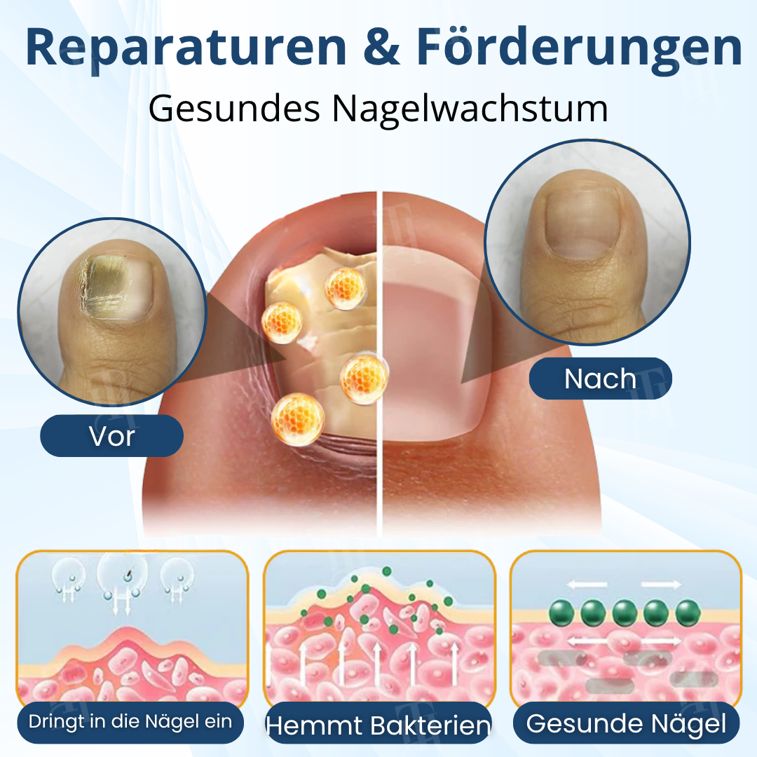 🏷️ EXKLUSIVES ANGEBOT! 50 % RABATT – AEXZR® MycoShield Pro Pilznagelpflaster