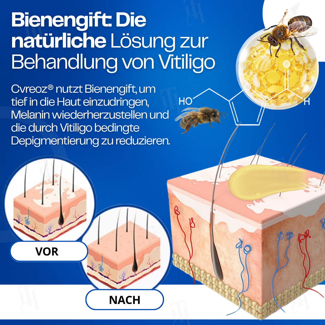 Cvreoz® VitiClear Bienengift Creme |Die Antwort der Natur für reine Haut✨