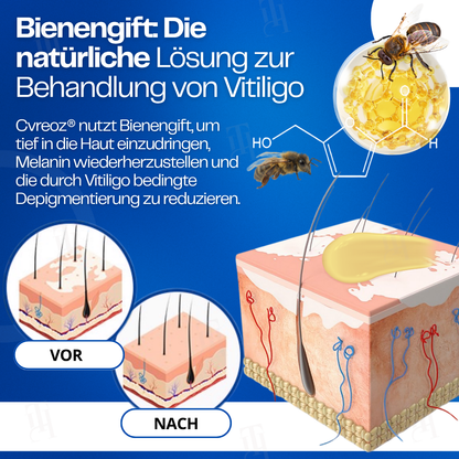 Cvreoz® VitiClear Bienengift Creme |Die Antwort der Natur für reine Haut✨