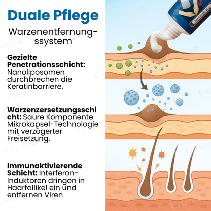 Cvreoz® HPV-Genitalwarzen Linderungscreme  | Nie wieder Juckreiz💕