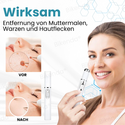 Bikenda® Nicht-invasiver Stift - und Warzenbehandlung Laserstift zum Entfernen