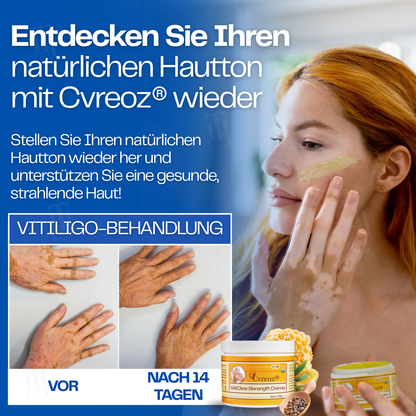 Cvreoz® VitiClear Bienengift Creme |Die Antwort der Natur für reine Haut✨