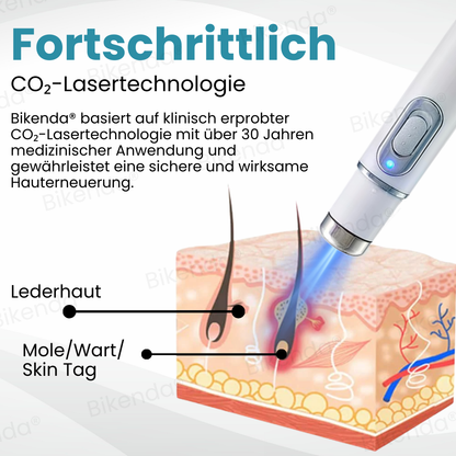 Bikenda® Nicht-invasiver Stift - und Warzenbehandlung Laserstift zum Entfernen
