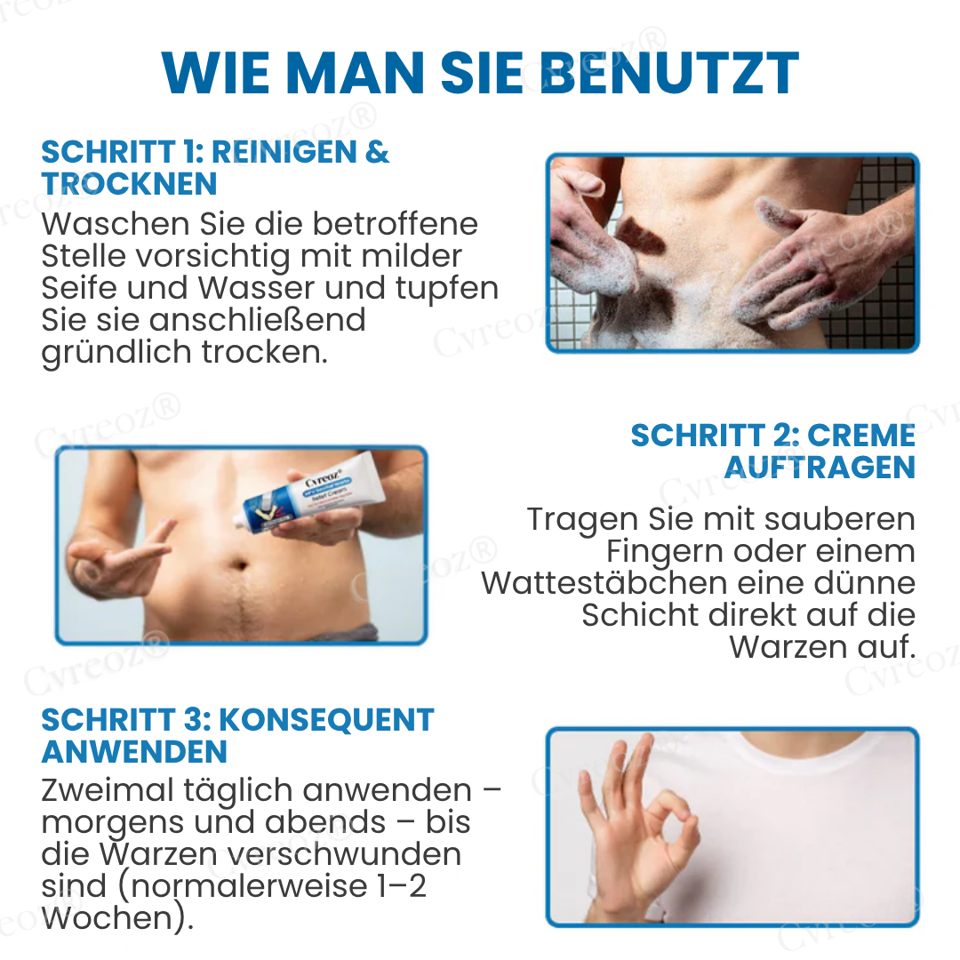 Cvreoz® HPV-Genitalwarzen Linderungscreme  | Nie wieder Juckreiz💕