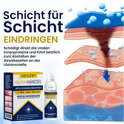 🏷️ EXKLUSIVES ANGEBOT! 50 % RABATT – AEXZR® Hautanhängsel-Kryo-Behandlungsspray