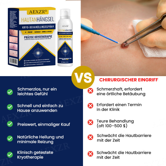 🏷️ EXKLUSIVES ANGEBOT! 50 % RABATT – AEXZR® Hautanhängsel-Kryo-Behandlungsspray