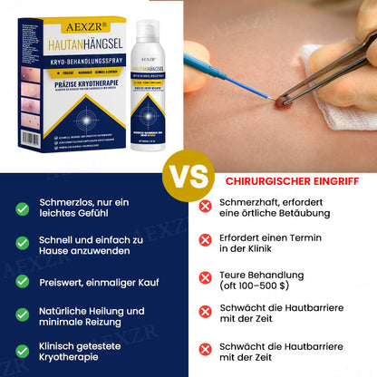 🏷️ EXKLUSIVES ANGEBOT! 50 % RABATT – AEXZR® Hautanhängsel-Kryo-Behandlungsspray